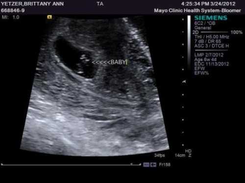 6 недель от зачатия беременности что происходит